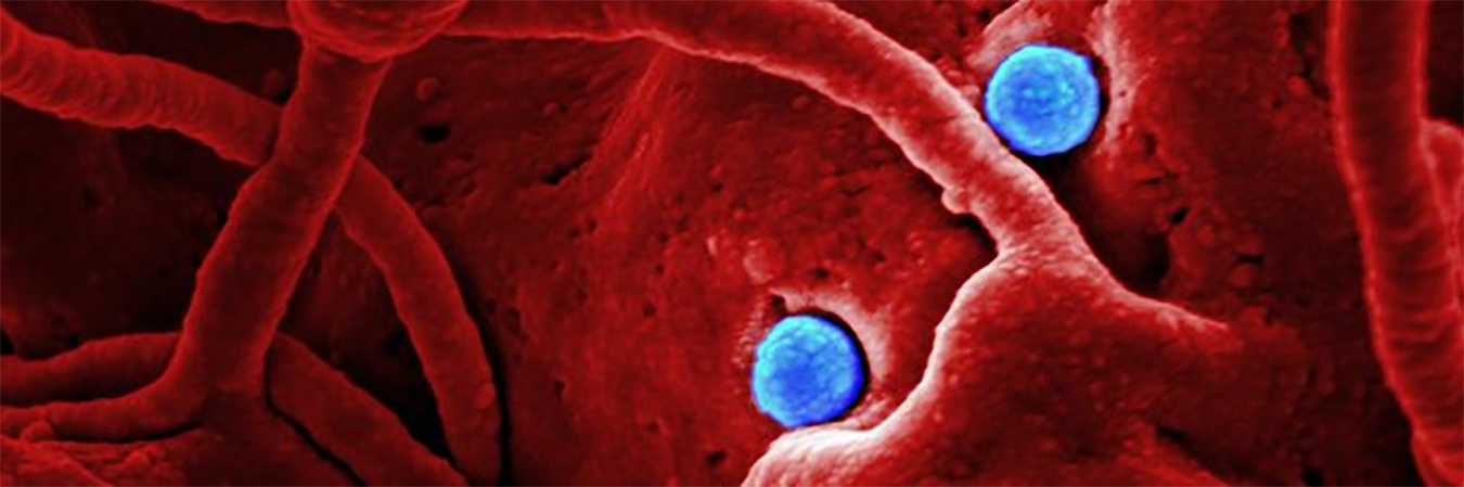 MERS CoV particles