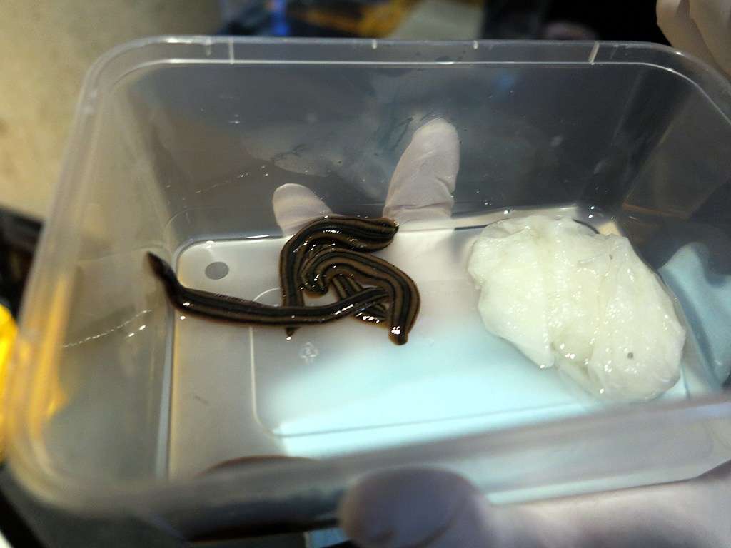 Beware, leeches! Leeches were commonly used by surgeons.