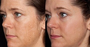 The key to a youthful face is good skin