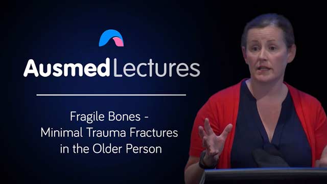 Cover image for lecture: Fragile Bones - Minimal Trauma Fractures in the Older Person