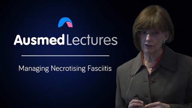 Cover image for lecture: Managing Necrotising Fasciitis