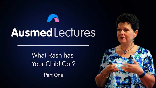 Cover image for lecture: What Rash has Your Child Got? (Part One)