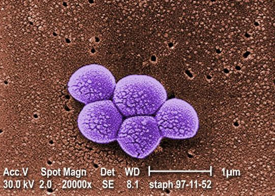 MRSA-image