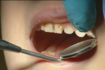 kids-teeth