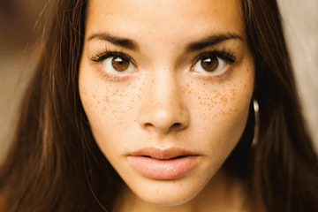 young_freckled_woman