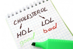 Paper with words HDL, LDL and cholesterol