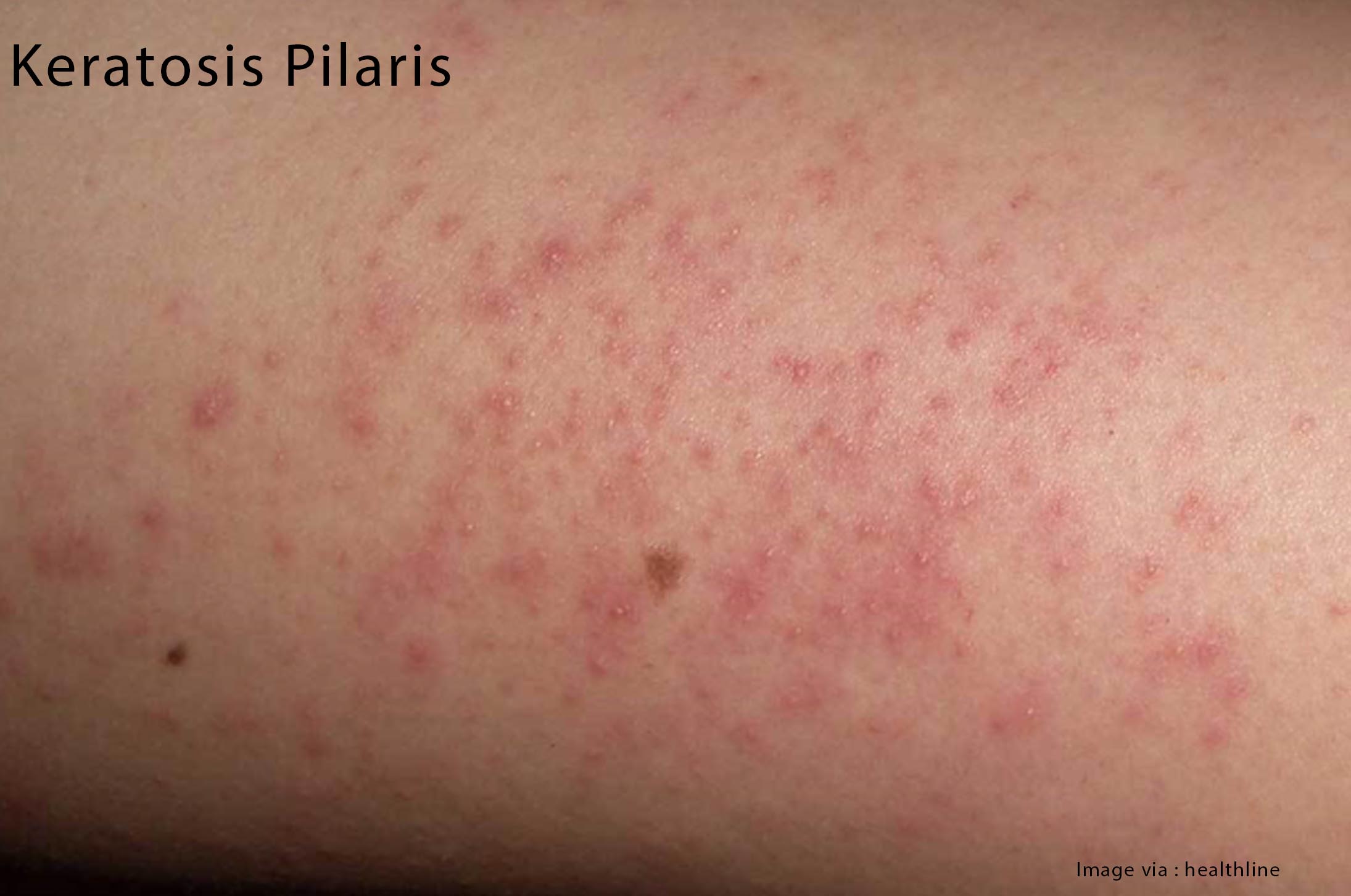 How to keep babies busy Choice Pharmacy