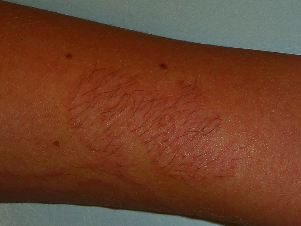 think before getting that tattoo doctor community news think before getting that tattoo doctor community news