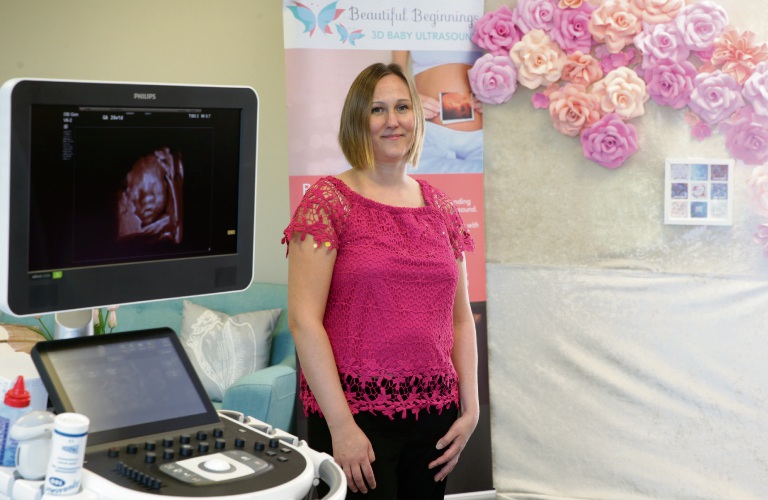 Joondalup Beautiful Beginnings offering mumstobe 3D ultrasounds