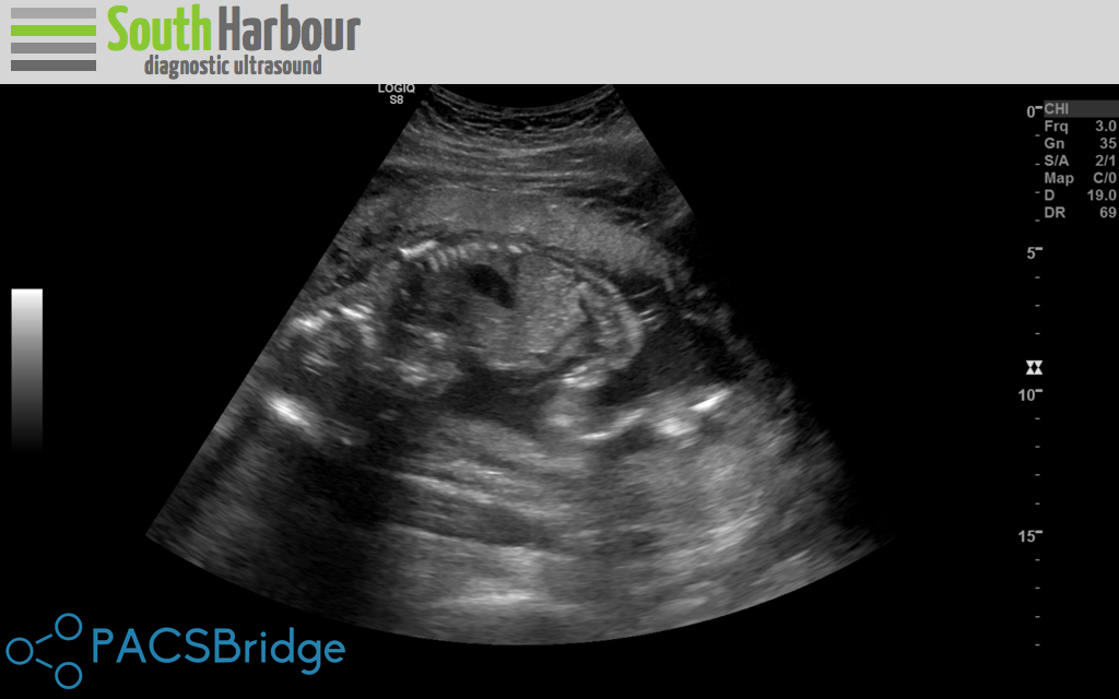 Ultrasound Image