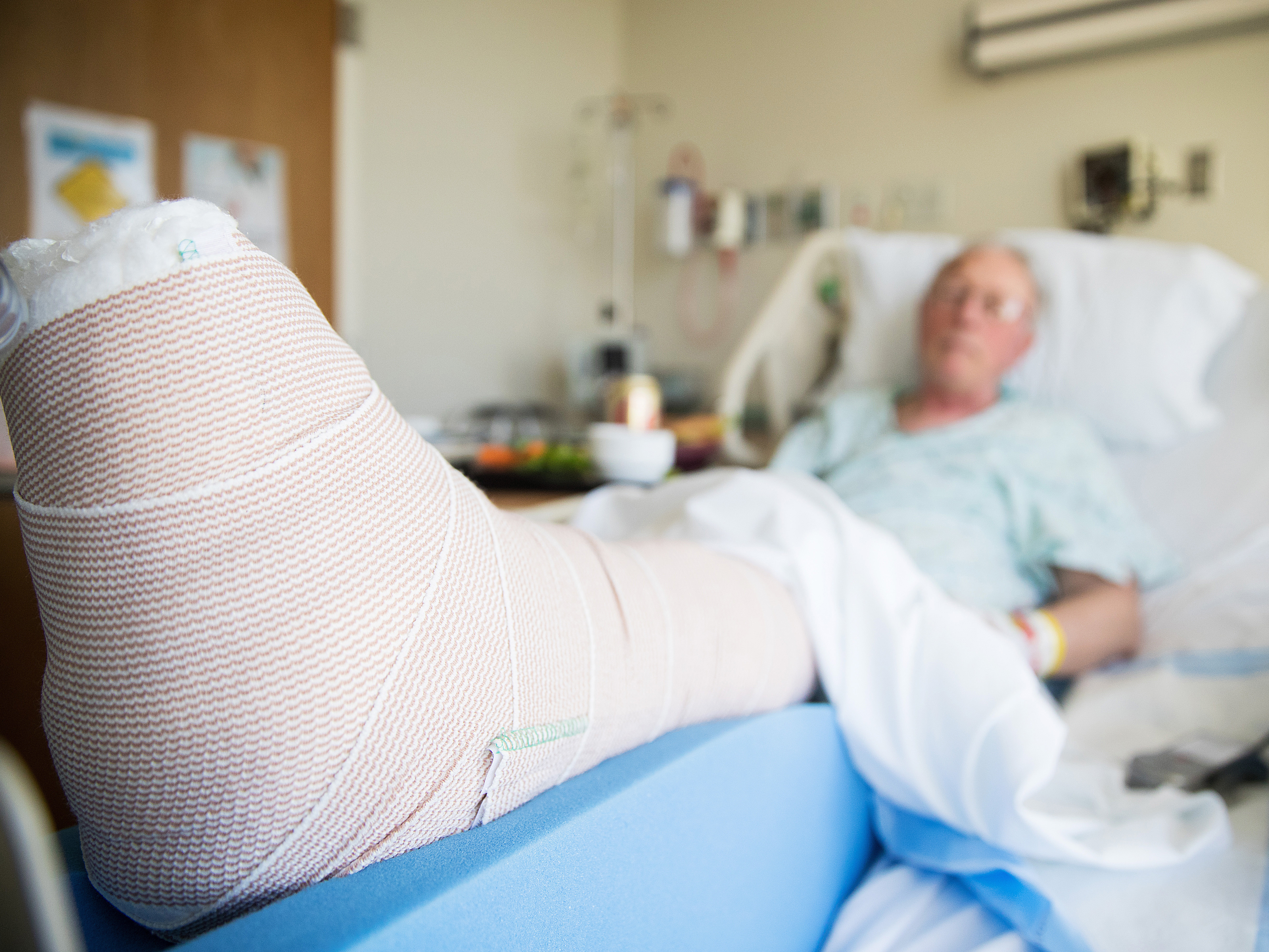 Older man in hospital with a broken leg after a fall.
