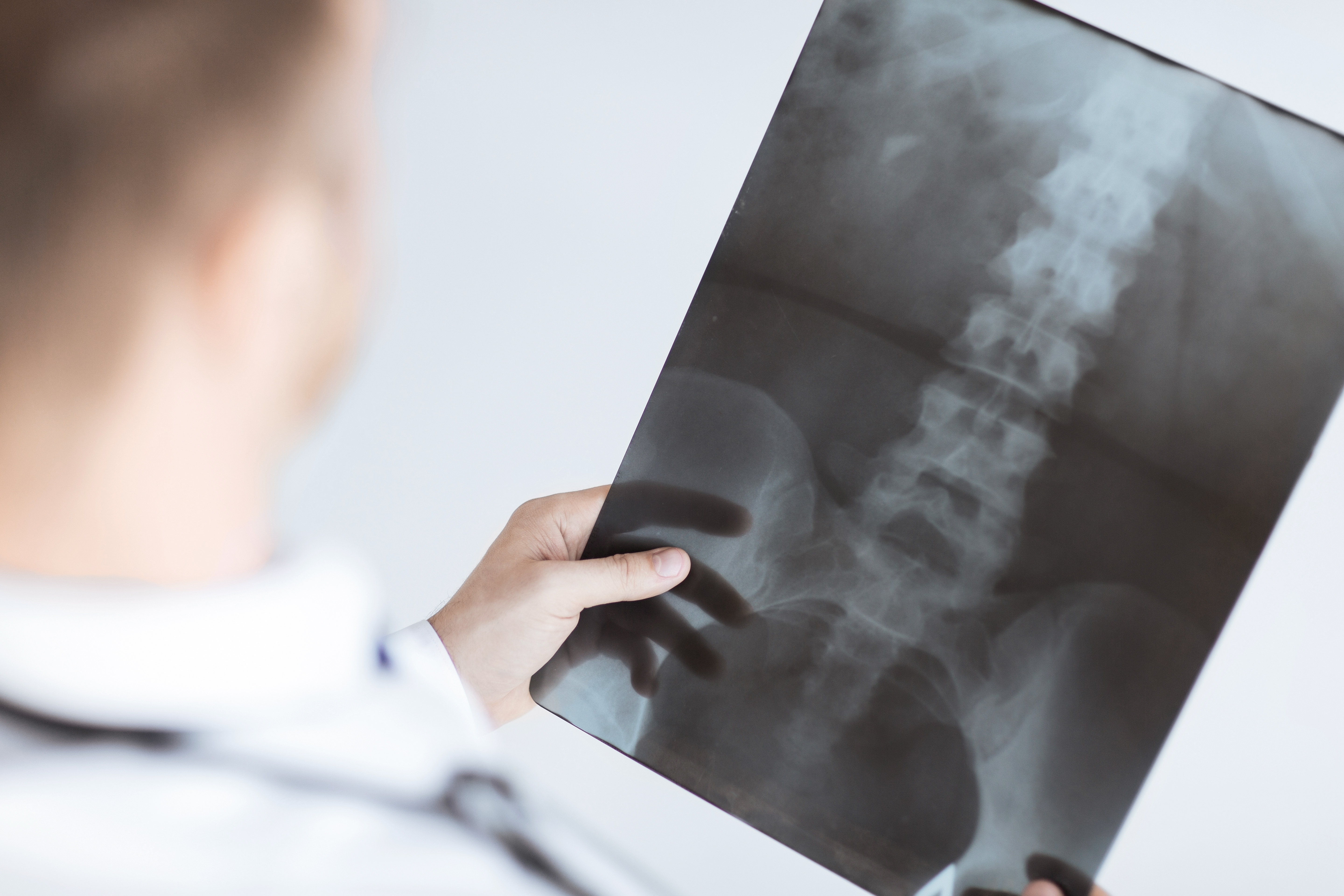 Spinal injuries