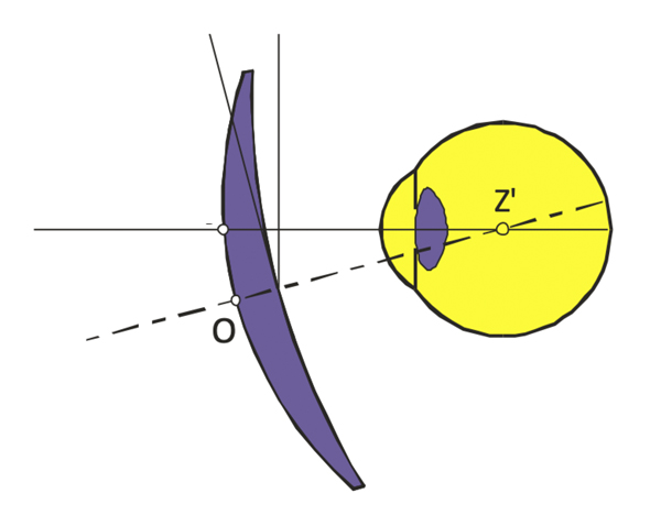 Lens Performance And The Relevance Of Measurements Anisometropia And Aspheric Single Vision Lenses
