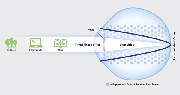Neurofocus mivision education
