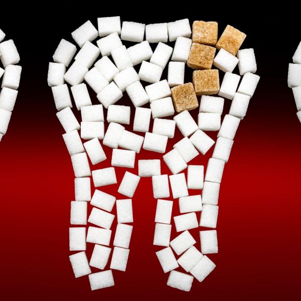 Sugar & Its Effect on Teeth - By Dr. Yen Tran