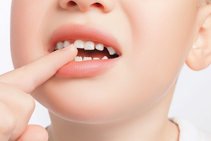 Your Child Has a Wobbly Tooth, What Now?