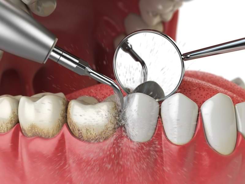 The Importance of Regular Dental Check-ups: Your Path to a Healthy Smile