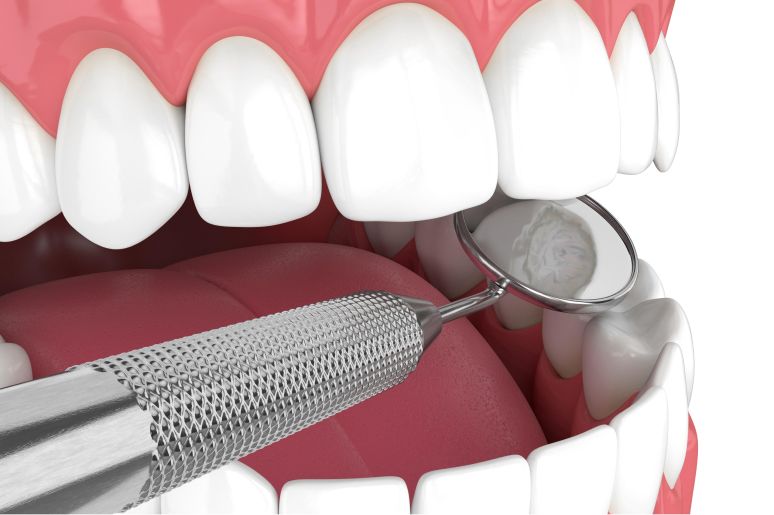 Why Regular Dental Visits Are Essential For Your Health
