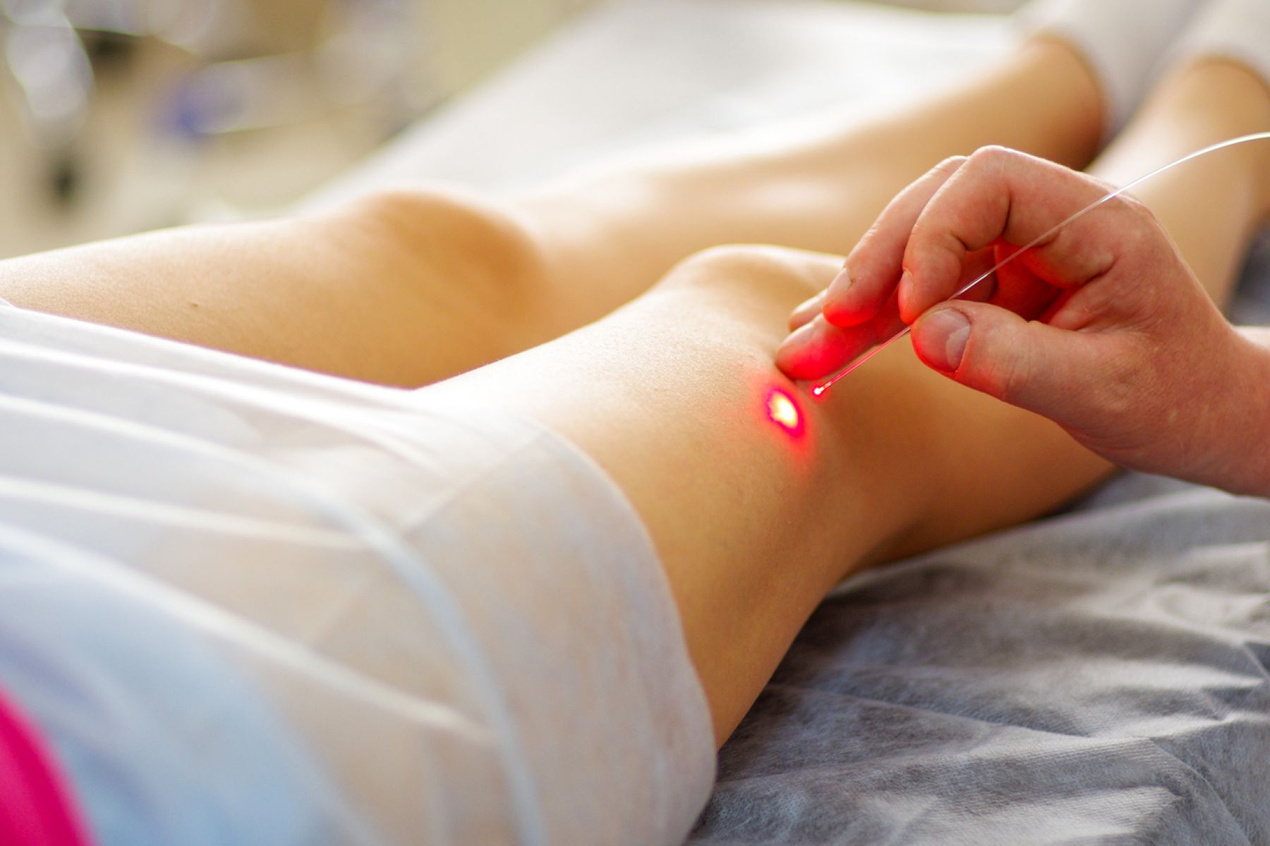 In-room varicose vein treatment now being offered at NQ Vascular! Image
