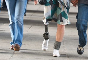 Prosthetics controlled by microprocessors Prosthetics controlled by microprocessors