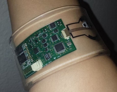 Wearable sweat sensor diagnoses cystic fibrosis Sweat
