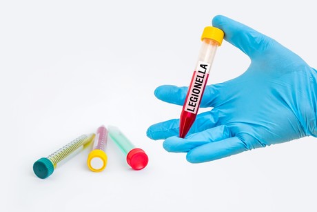 Patients in healthcare facilities at risk for legionnaire's disease Adobestock 115314692