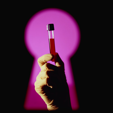 Alzheimer's diagnosis may soon be possible with a simple blood test 54081