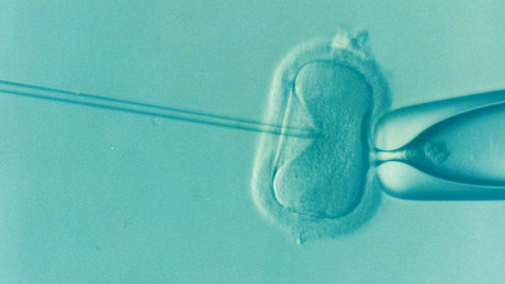 Imaging technique to aid IVF embryo selection Ivf