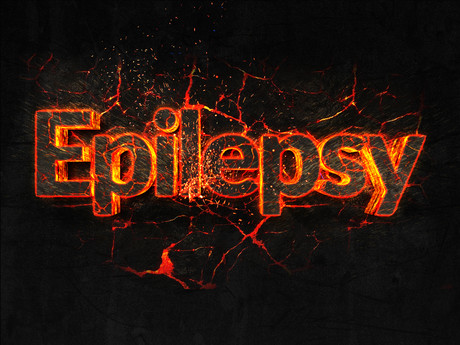 Epilepsy seizure prediction possible with AI Adobestock 181924937