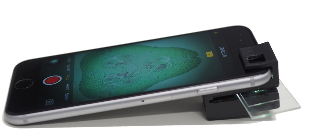 Clip-on technology turns your smartphone into a microscope