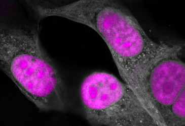 CRISPR gene-editing tool targets RNA, tackles dementia CRISPR gene-editing tool targets RNA, tackles dementia