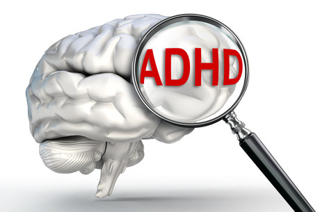 ADHD preschoolers have reduced brain volume Adobestock 95104500