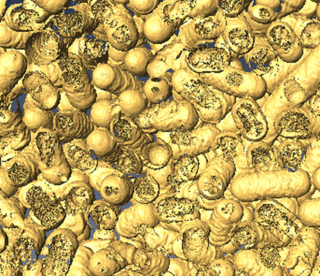 Artificial enzymes use light to kill bacteria Dead bacteria3 vb