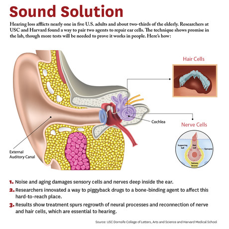 Hope for hearing loss Ear graphic usc study