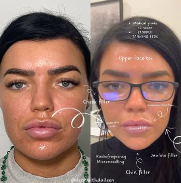Facial Balancing