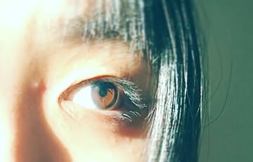 Golden Iris – One-Eyed Self Portrait