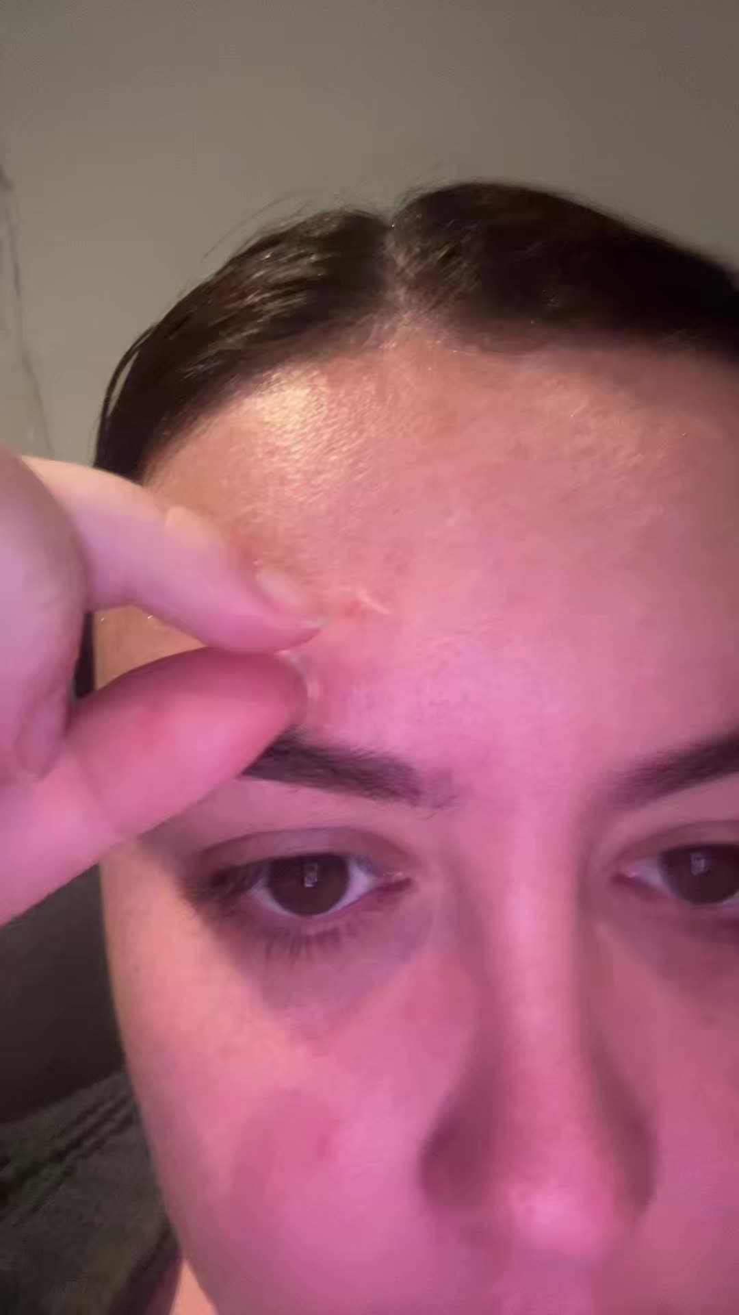 Derma Angel