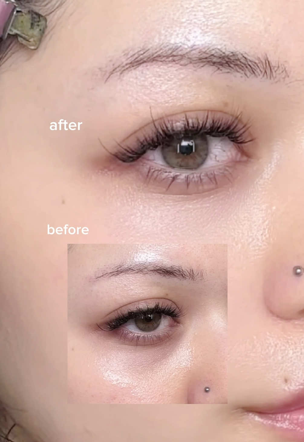 KSECRET - improve dark circles in just 7 days!