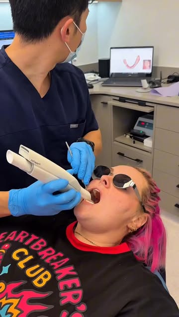 Linea Aligners