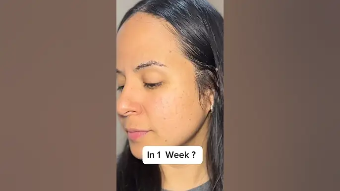 Serum for Active Breakout PEPTATHENOL10  brand Another face