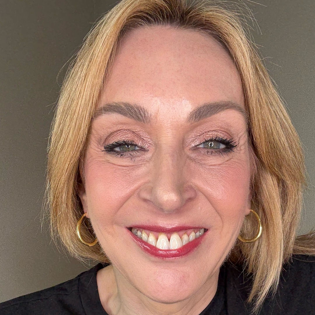 Kate Dove