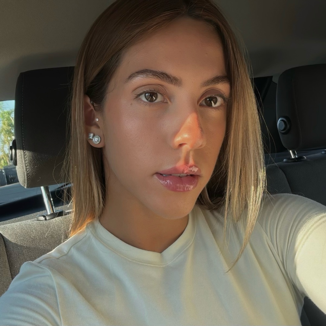 Esther Hadassa