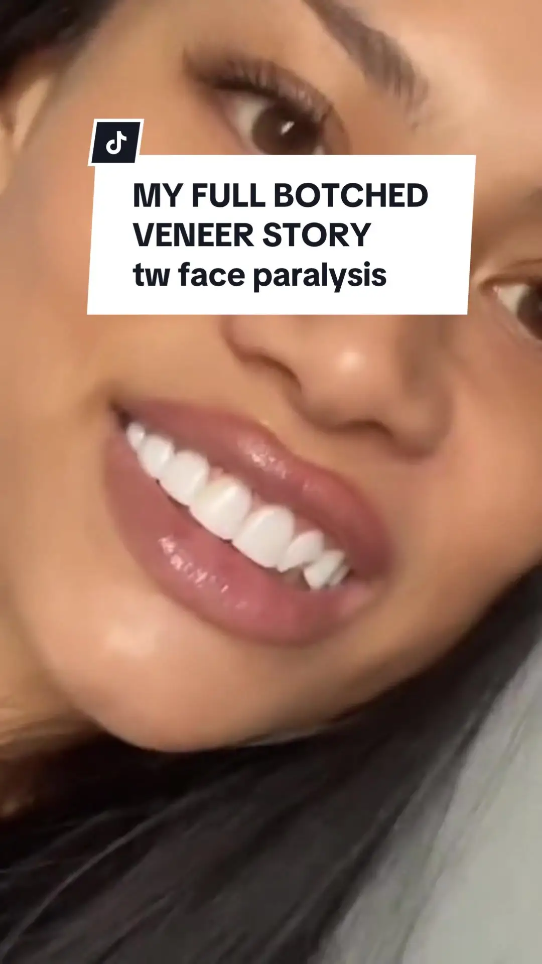 Tiktok post thumbnail