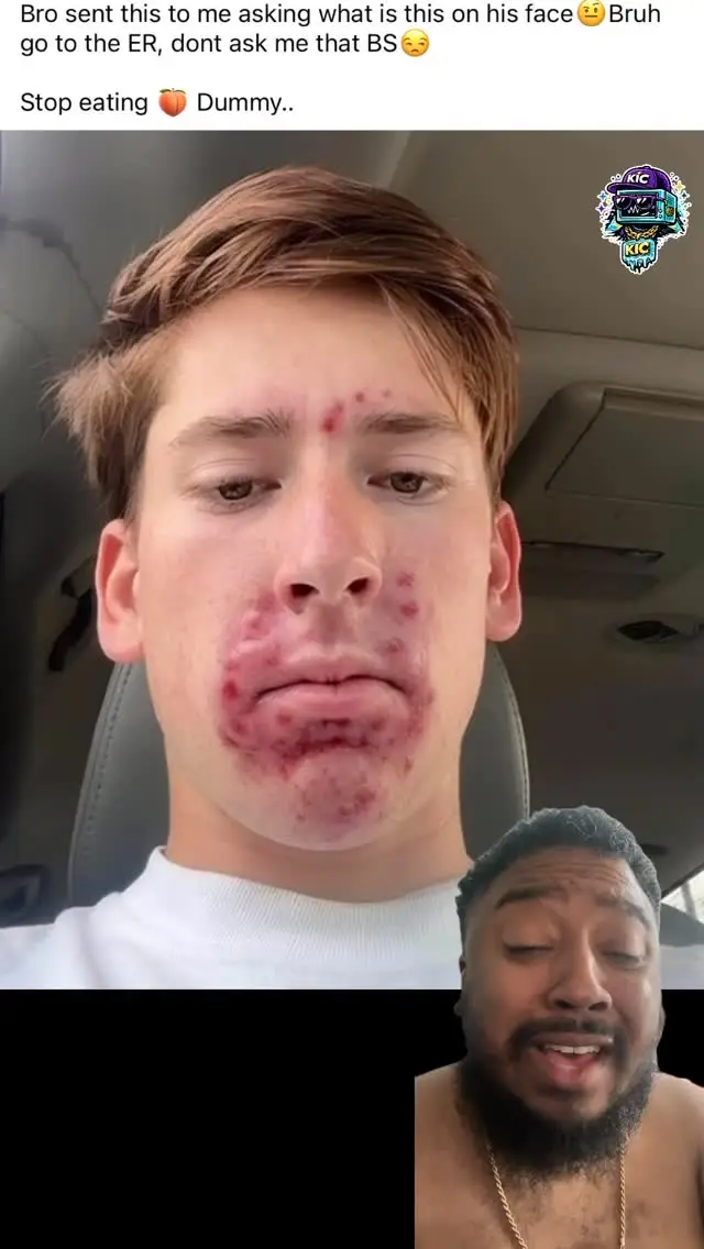 Instagram post thumbnail