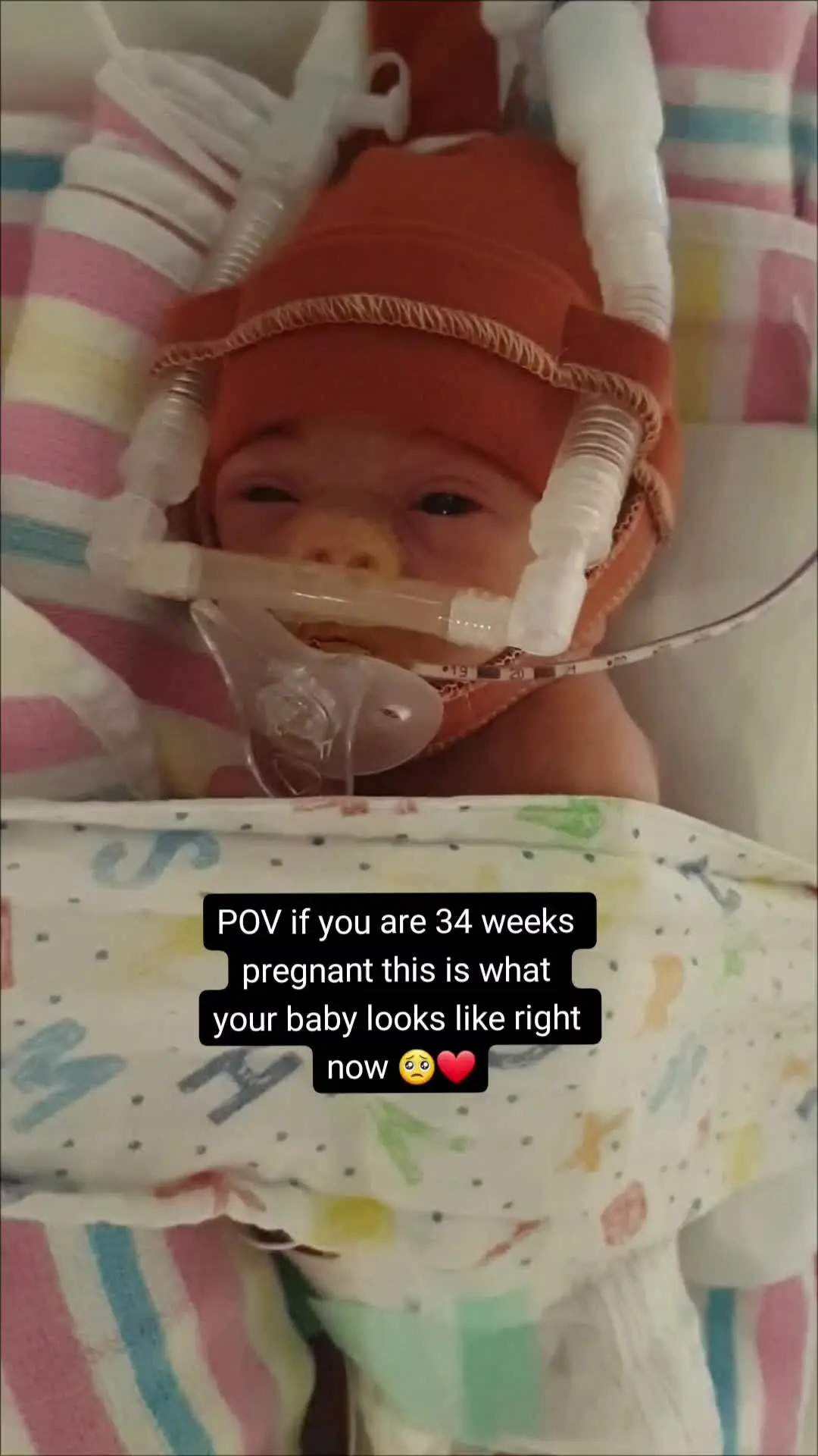 Tiktok post preview 3 from @babymasonsmummy
