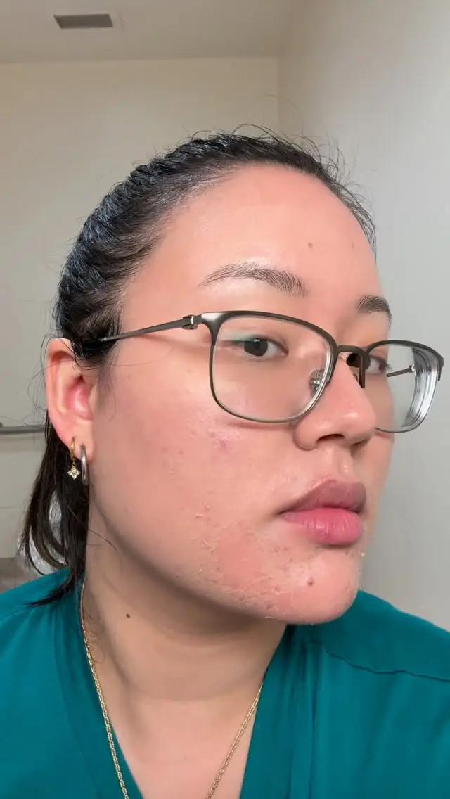 Instagram post thumbnail