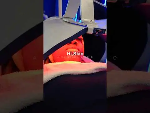 Youtube post thumbnail