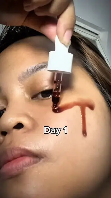 Instagram post thumbnail