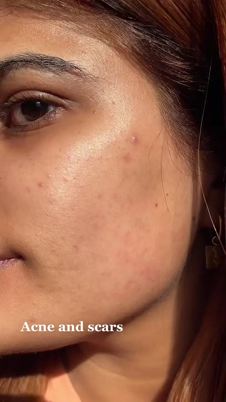 Tiktok post preview 3 from @skincarewith_me
