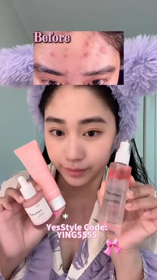 Instagram post thumbnail